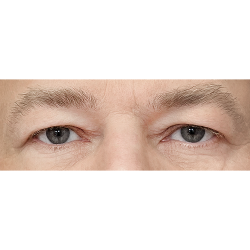 Miszczyk2A-1-aspect-ratio-500-500