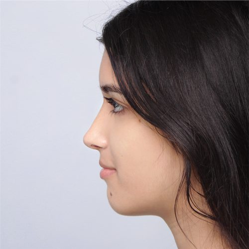 12B-Copy-aspect-ratio-500-500