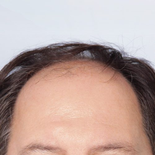 18A-59422-aspect-ratio-500-500