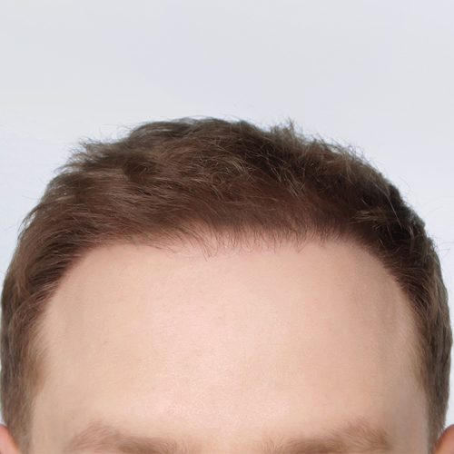 21B-090524-aspect-ratio-500-500