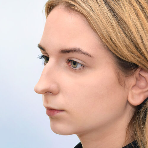 michal14a-aspect-ratio-500-500