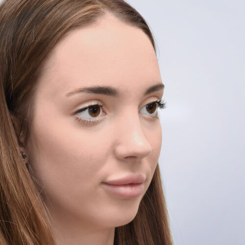 michal26b-aspect-ratio-500-500
