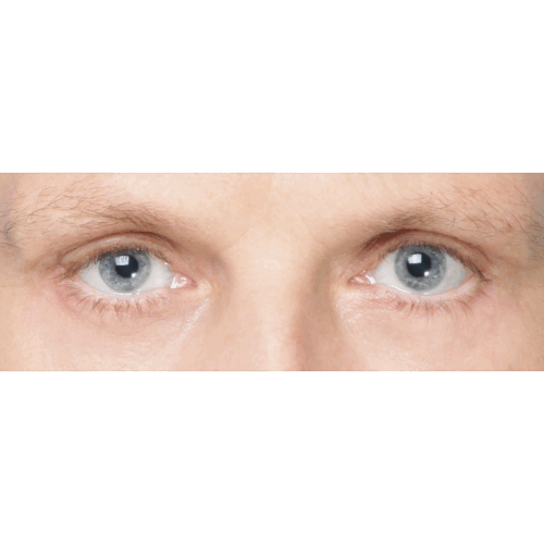 miszczyk4b-aspect-ratio-500-500