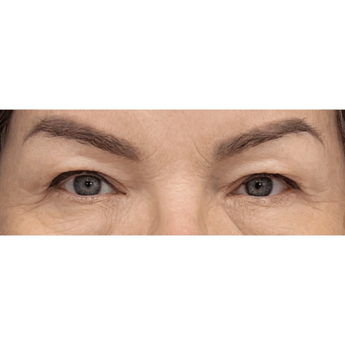 miszczyk5a-aspect-ratio-500-500