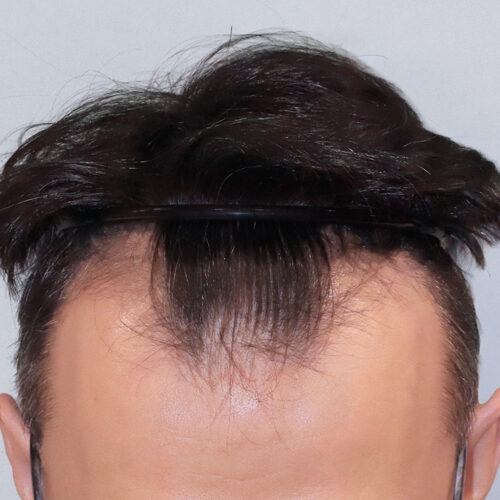 wlosy-34a-aspect-ratio-500-500