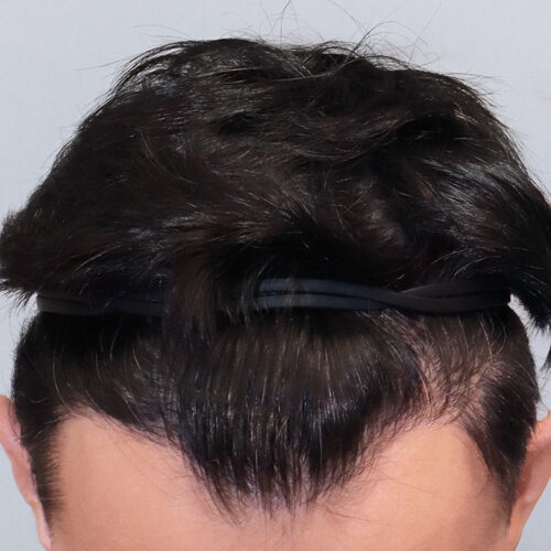 wlosy-34b-aspect-ratio-500-500