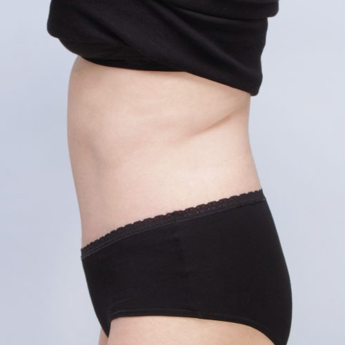 Ferenc4B-62639-1-aspect-ratio-500-500