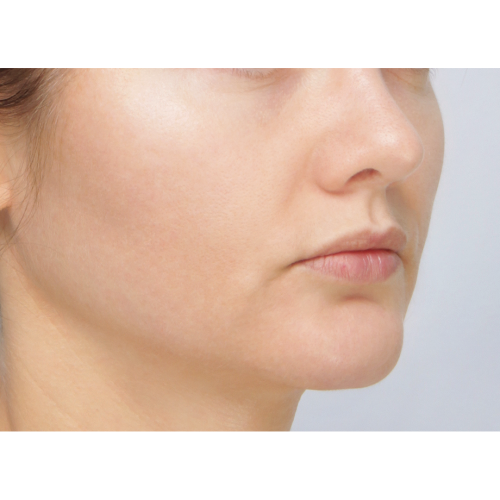 miszczyk-policzek-4c-aspect-ratio-500-500