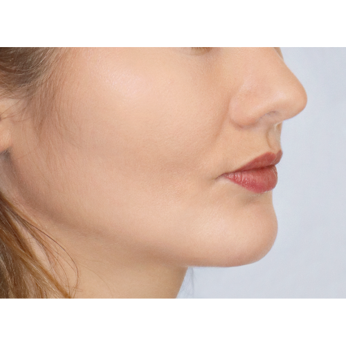 miszczyk-policzek-4d-aspect-ratio-500-500