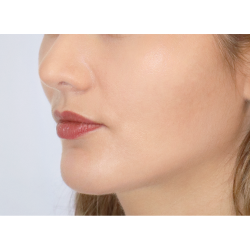 miszczyk-policzek-4f-aspect-ratio-500-500