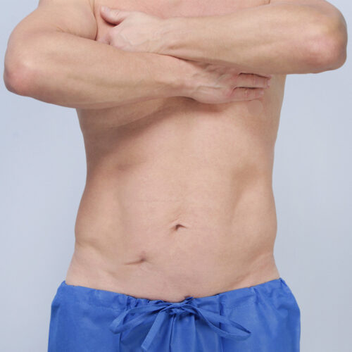 ferenc-brzuch-65546-6a-aspect-ratio-500-500