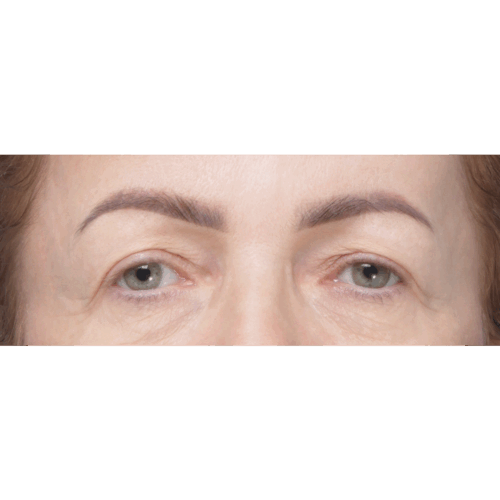 miszczyk-endo-id69774-15a-aspect-ratio-500-500