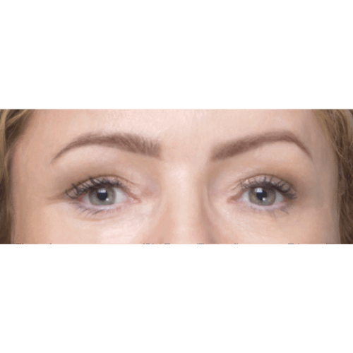 miszczyk-endo-id69774-15b-aspect-ratio-500-500