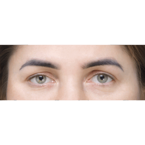 miszczyk-endo-id70745-17a-aspect-ratio-500-500