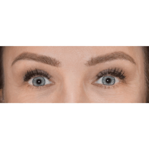 miszczyk-lift-brwi-11b-aspect-ratio-500-500