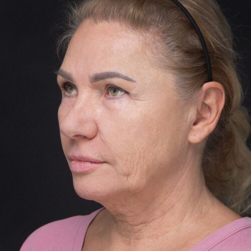 daria-dpfl–id64693-9g-aspect-ratio-500-500