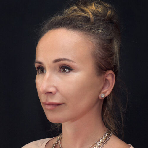 michal-dpfll–id72069-21d-aspect-ratio-500-500