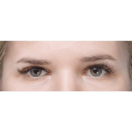 miszczyk-endo-brwi-id70212-19a-aspect-ratio-500-500