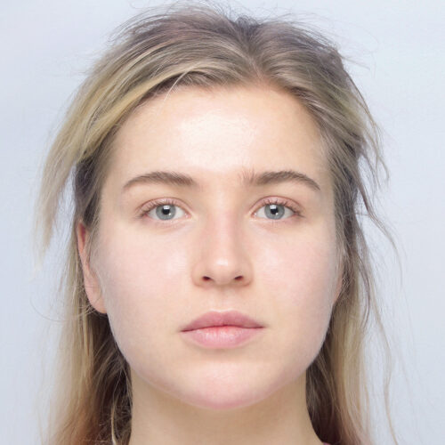 miszczyk-endo-midface-id69774-6a-aspect-ratio-500-500