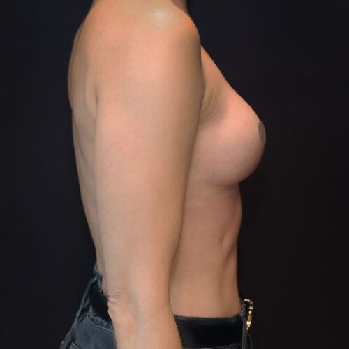 daria-id48910-2b-aspect-ratio-500-500