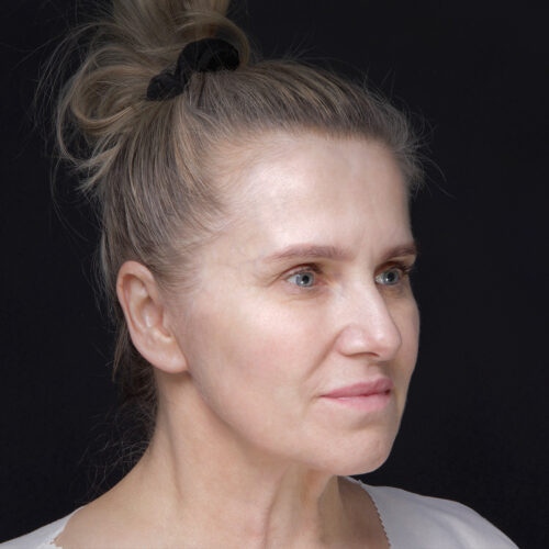 daria-dpfl–dzien-zabiegu-1id59916-15c1-aspect-ratio-500-500