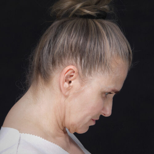 daria-dpfl–dzien-zabiegu-2id59916-15e1-aspect-ratio-500-500