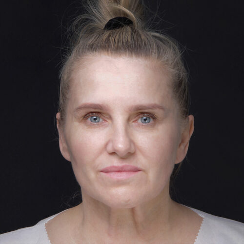 daria-dpfl–dzien-zabiegu-id59916-15a1-aspect-ratio-500-500