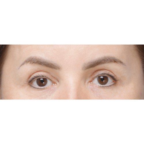 miszczyk-endo-brwi-id72183-21a-aspect-ratio-500-500