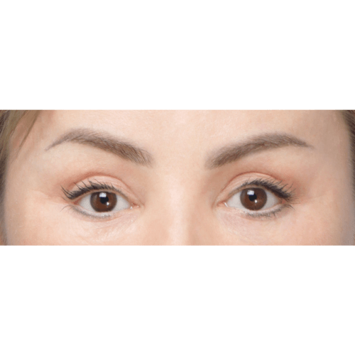 miszczyk-endo-brwi-id72183-21b-aspect-ratio-500-500