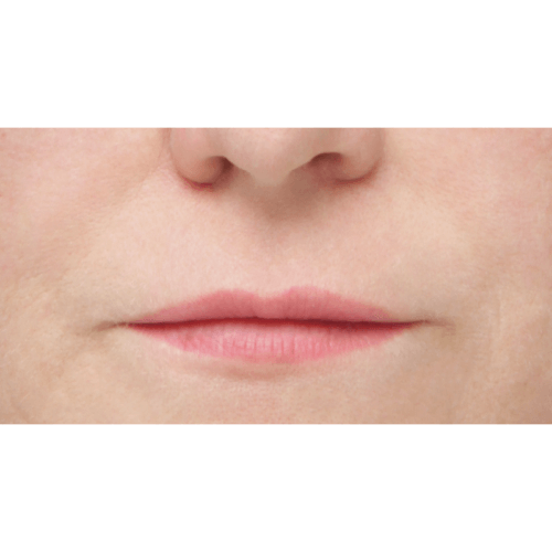 miszczyk-liplift-id72183-4a-aspect-ratio-500-500