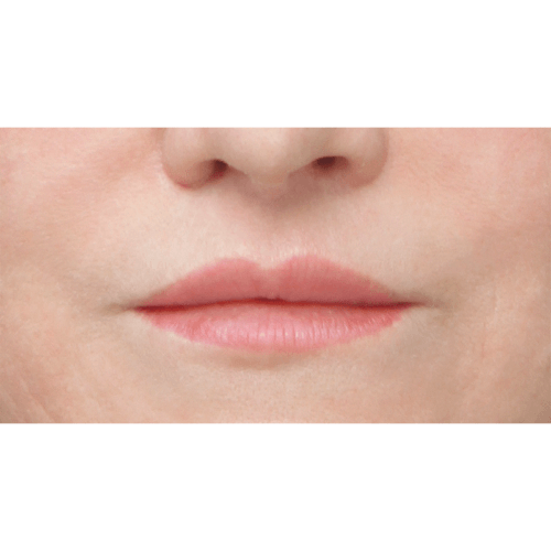 miszczyk-liplift-id72183-4b-aspect-ratio-500-500