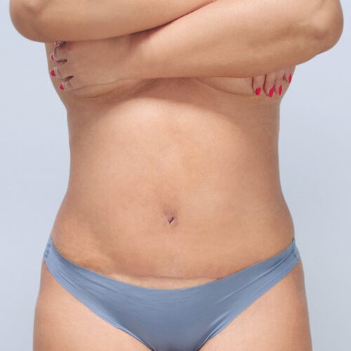 1-b-kulesza-brzuch-id69112-b-aspect-ratio-500-500