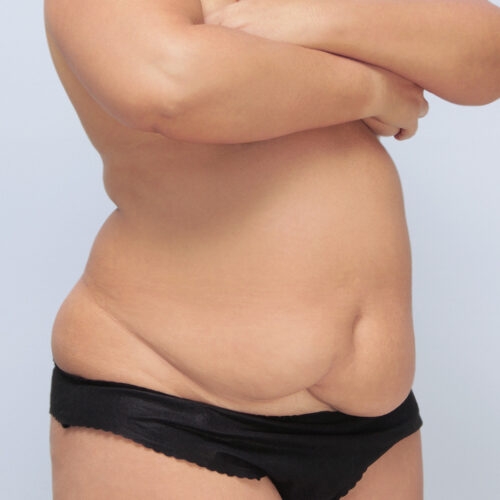 1-c-kulesza-brzuch-id69112-c-aspect-ratio-500-500