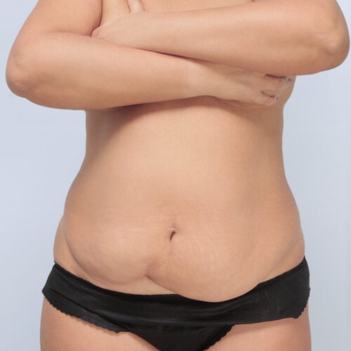 1a-kulesza-brzuch-id69112-a-aspect-ratio-500-500