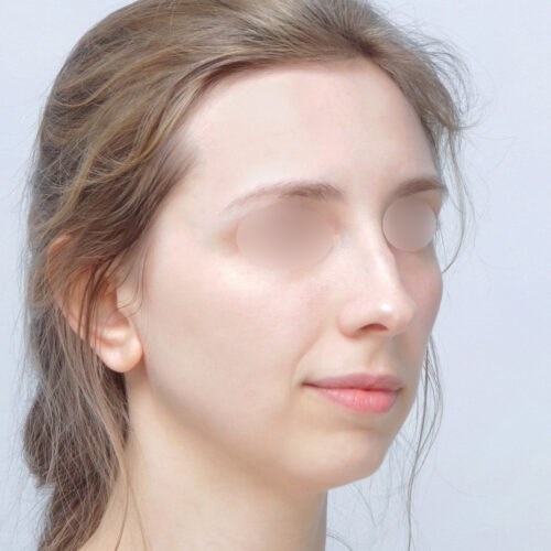 ferenc-nos-id67947-1a-1-aspect-ratio-500-500