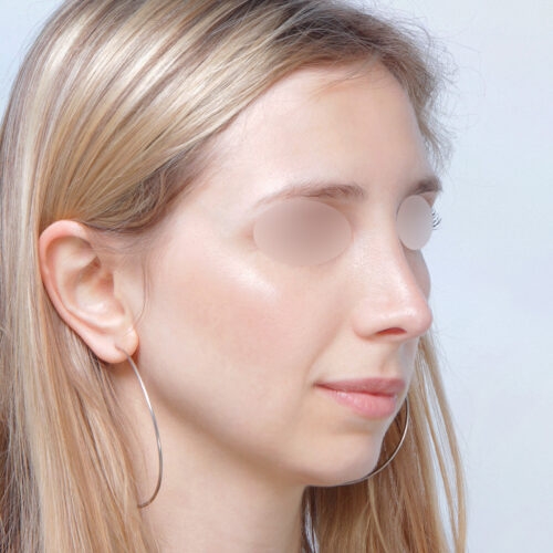 ferenc-nos-id67947-1b-1-aspect-ratio-500-500