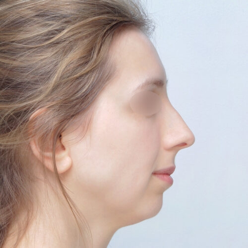 ferenc-nos-id67947-1c-1-aspect-ratio-500-500