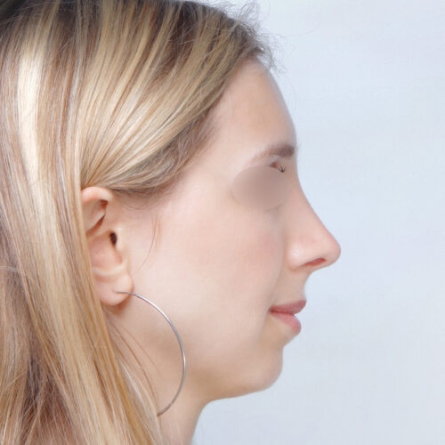 ferenc-nos-id67947-1d-1-aspect-ratio-500-500