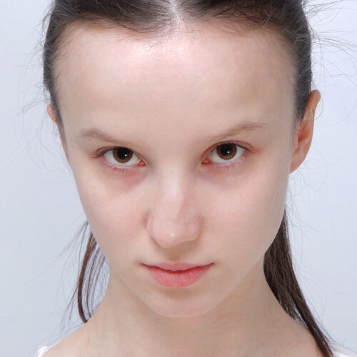stabryla-korekcja-nosa-id21193-14a-aspect-ratio-500-500