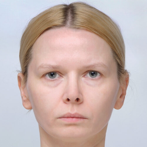 miszczyk-endoskopowy-lifting-brwi-id71781-24a-aspect-ratio-500-500
