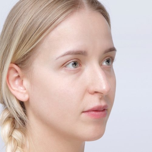 michal-korekcja-nosa-id62614-zgoda-39a-aspect-ratio-500-500