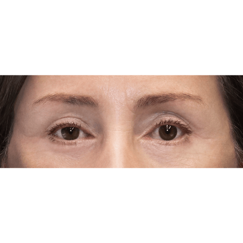 michal-lifting-brwi-id63199-9b-aspect-ratio-500-500