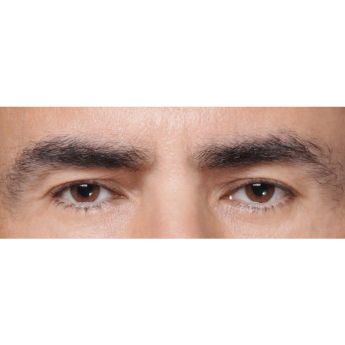michal-lifting-brwi-id71733-12a-aspect-ratio-500-500