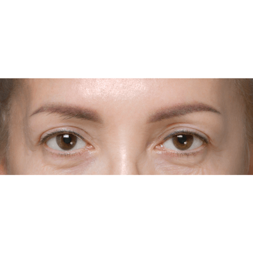 michal-lifting-brwi-id71775-13a-aspect-ratio-500-500