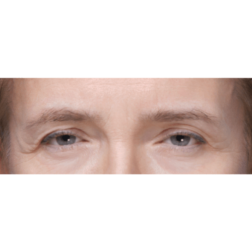 michal-lifting-brwi-id71887-10a-aspect-ratio-500-500