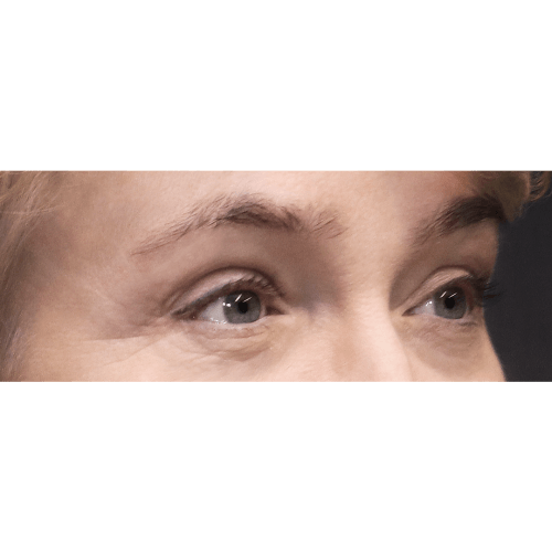 michal-lifting-brwi-id71887-10d-aspect-ratio-500-500