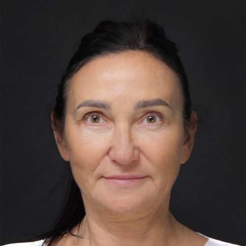 michal-dpfl-id66952-23a-aspect-ratio-500-500