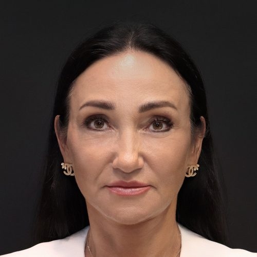 michal-dpfl-id66952-23b-aspect-ratio-500-500