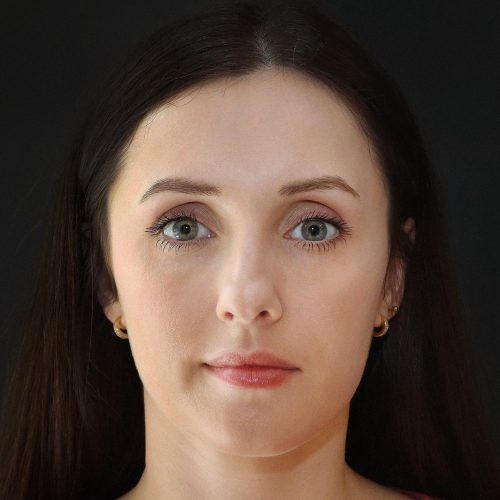 michal-korekcja-nosa-zgoda-44a-aspect-ratio-500-500