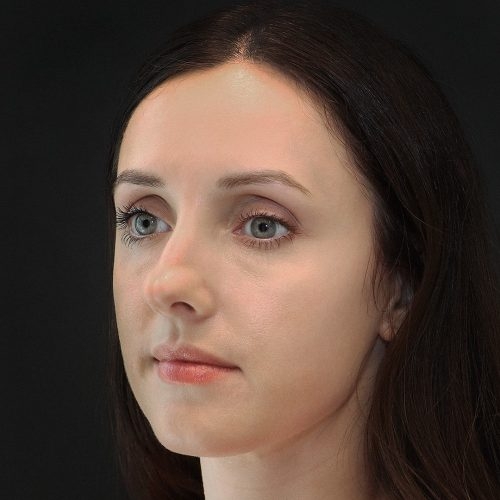 michal-korekcja-nosa-zgoda-44g-aspect-ratio-500-500
